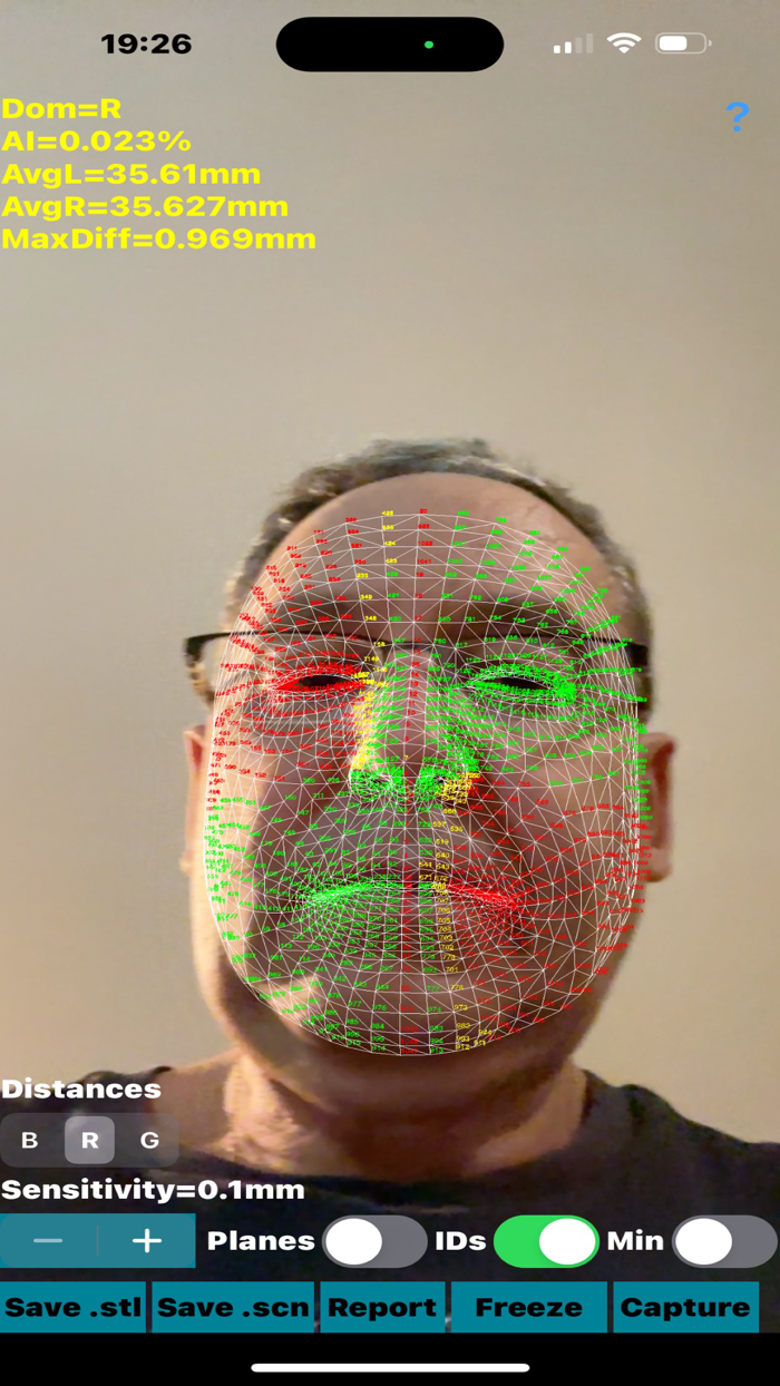 Dynamic3DFaceAsymmetryApp