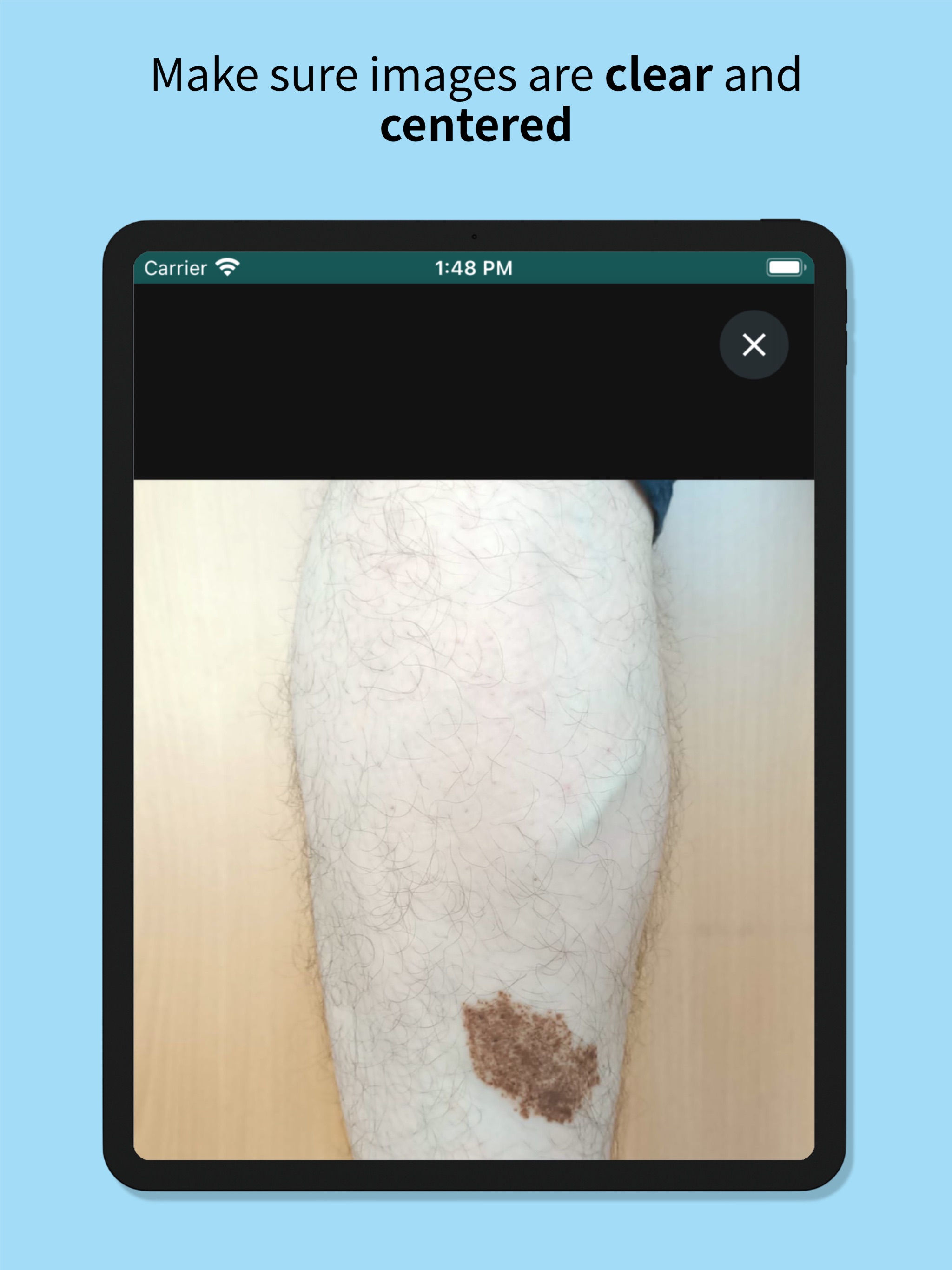 Skin Check: Dermatology Appのおすすめ画像4