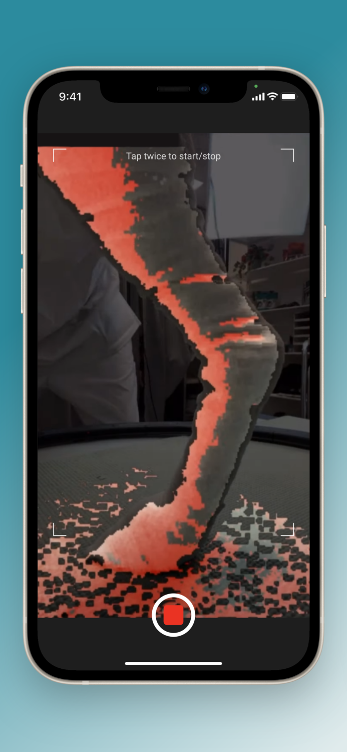 Scandi Orthopedic 3D Scanner