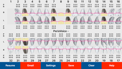 PerioVoice Pro Dental Charting Screenshot