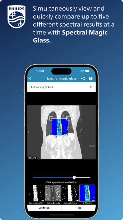 Philips CT Learning screenshot-3