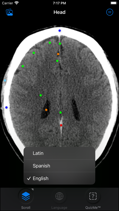 CT Anatomy Screenshot