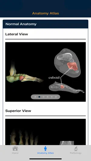 CTisus: CT of the Foot screenshot 2