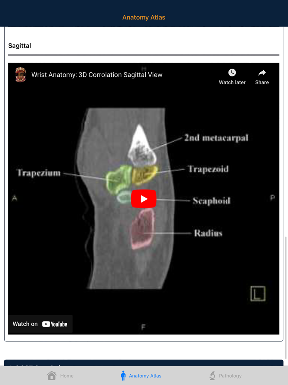 CTisus: CT of the Hand & Wrist iPad screenshot 6 - Medical app