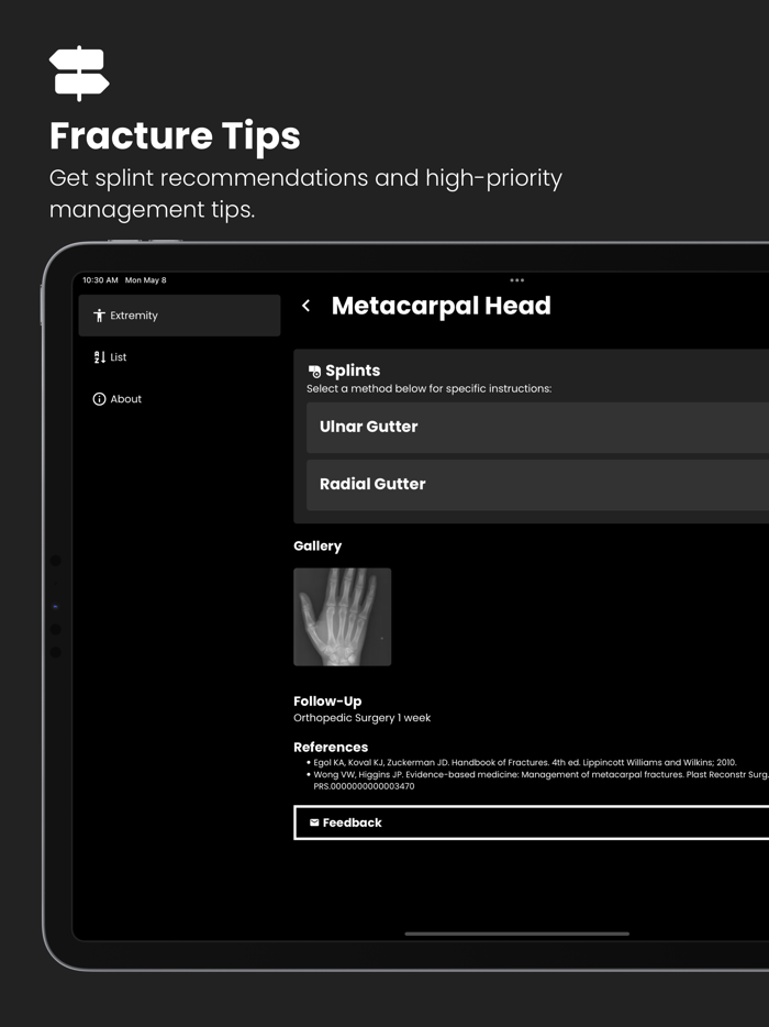 Fractures Splinting App