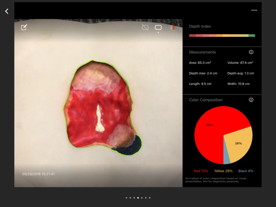 Screenshot #5 pour eKare inSight Healthcare