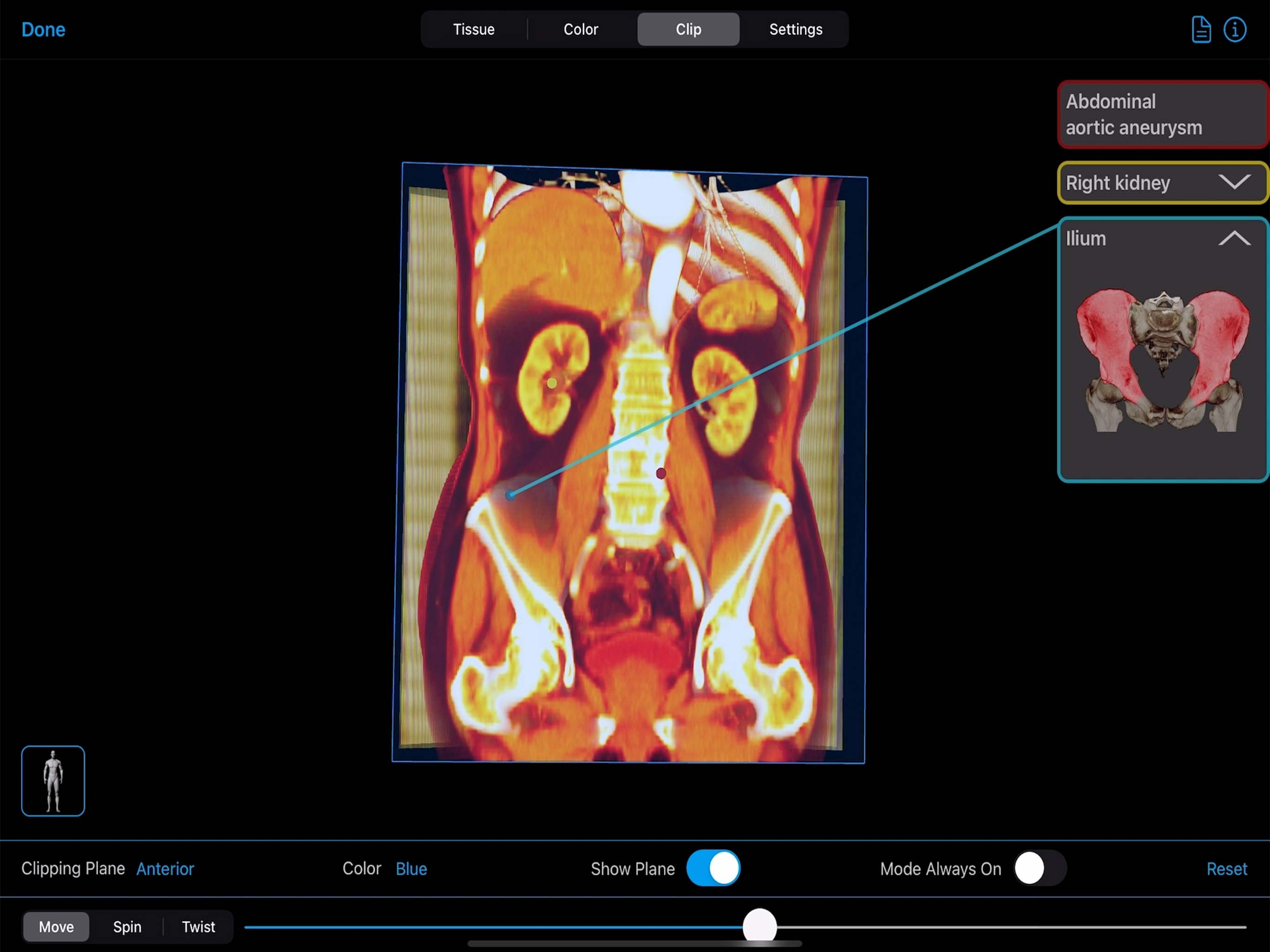BodyViz