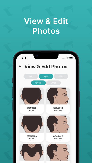 Hairly: Fight Hair Loss Screenshot