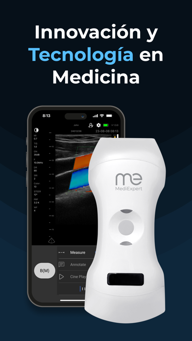 SonoExpert - MediExpert Screenshot