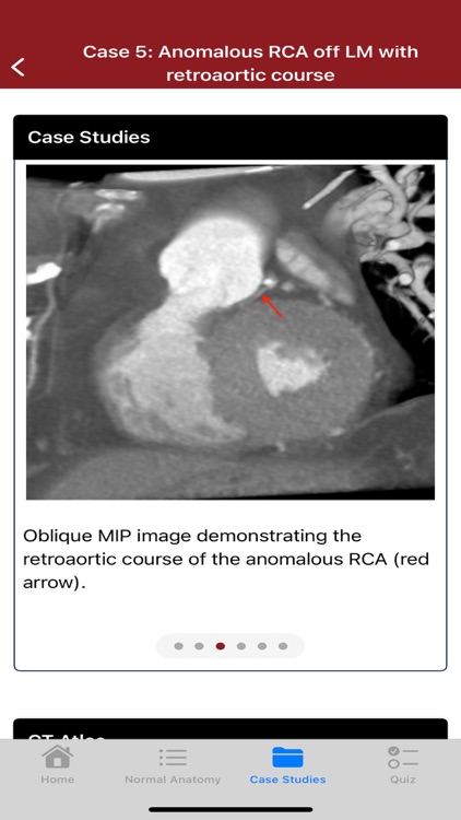 CTisus CT Coronary Arteries screenshot-4