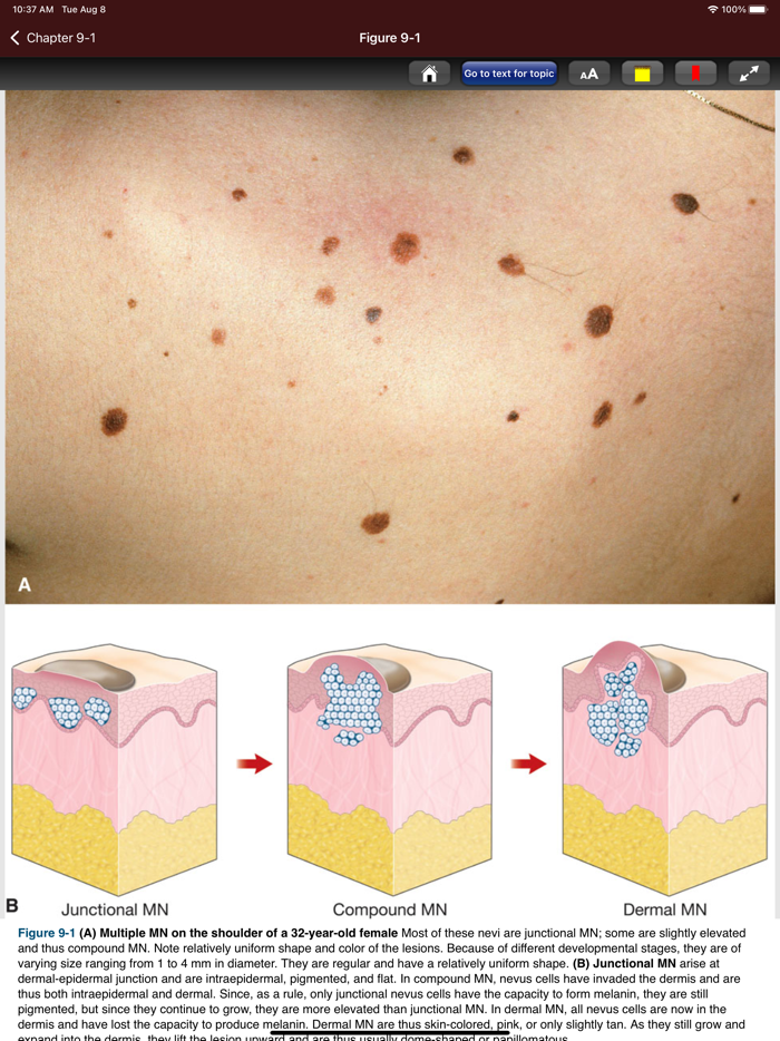Fitzpatricks Atlas-Synopsis 9E