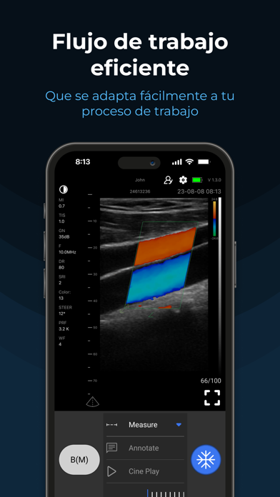 SonoExpert - MediExpert Screenshot
