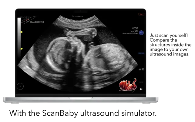 Captura 2 ScanBaby ultrasonido del bebé iphone