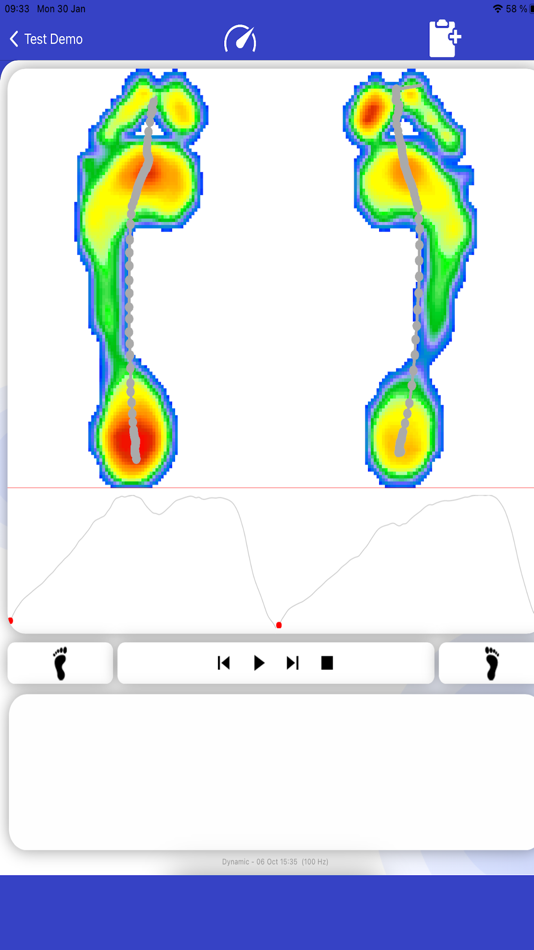 #3. PodoCapture (iOS) 来自: Medicapteurs