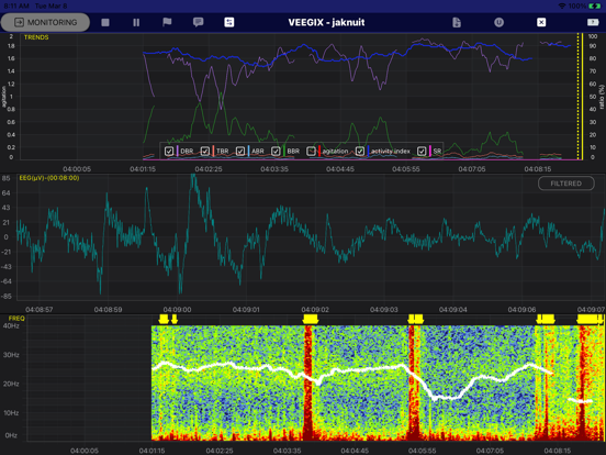 Screenshot #6 pour VEEGix EEG