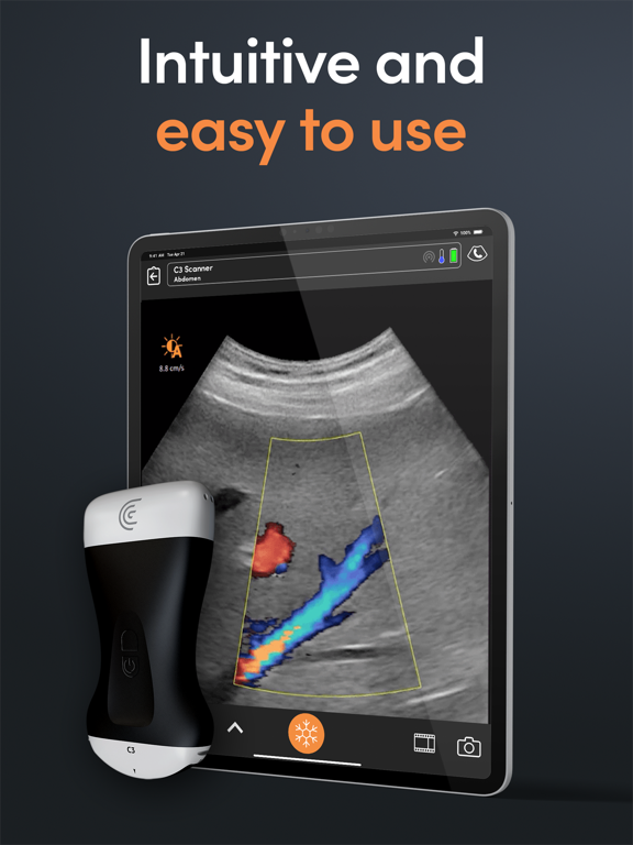 Screenshot #4 pour Clarius Ultrasound App