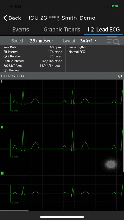 Mindray Mobile Viewer II screenshot-3
