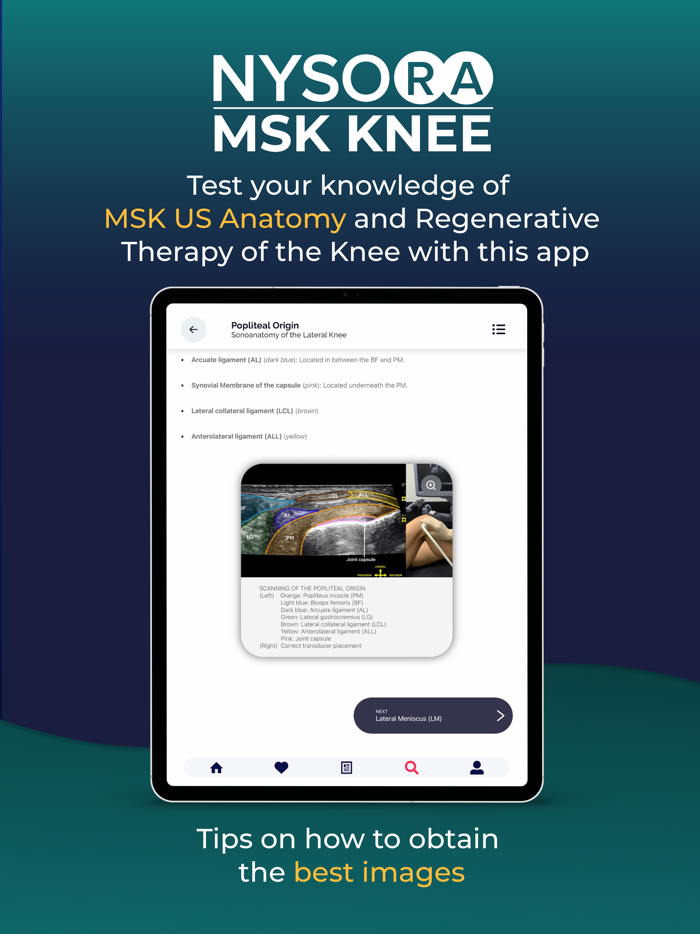 NYSORA MSK US Knee