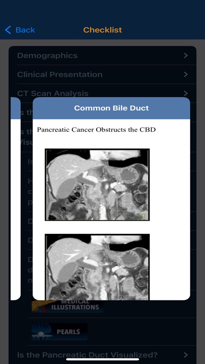 CTisus Pancreas Mass Checklist screenshot-5