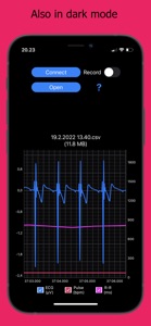 ECG Logger for Polar H10 screenshot #2 for iPhone