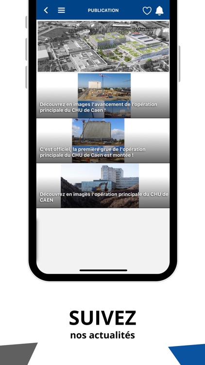 CHU CAEN Opération Principale