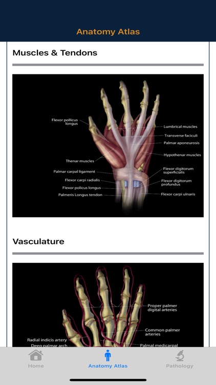 CTisus: CT of the Hand & Wrist