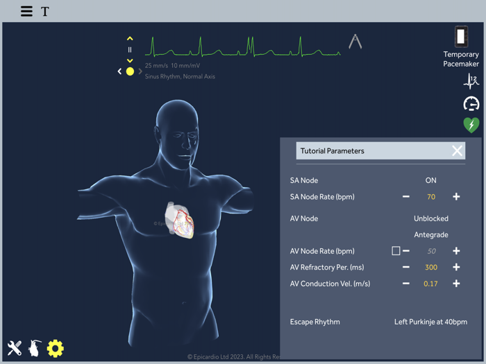 Temporary Cardiac Pacing