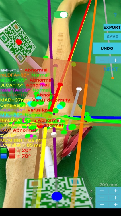 KneeNaviAR screenshot-5