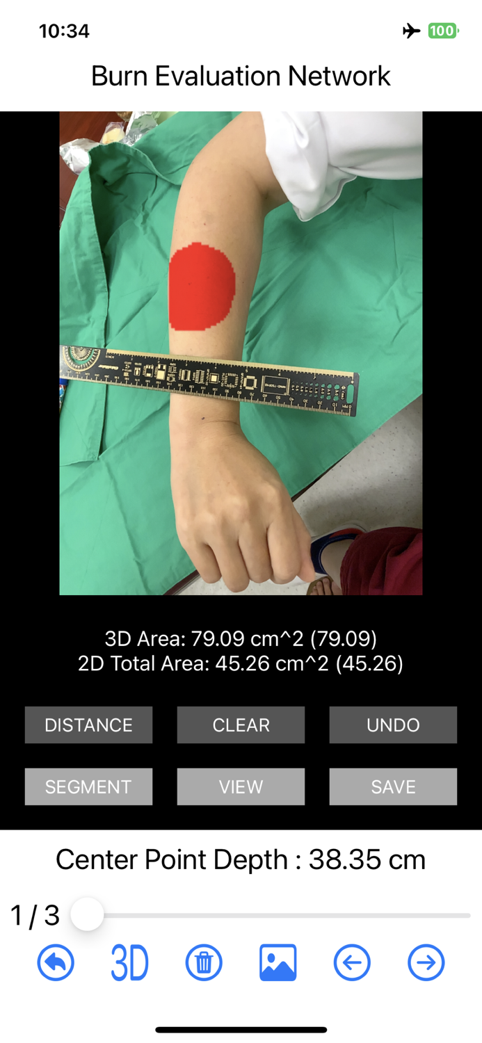 Burn Evaluation Network