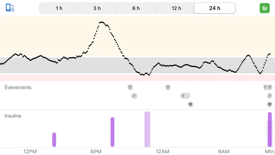 Capture d'écran de Dexcom G6 Mg/dL DXCM2 sur iPhone 2