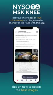 nysora msk us knee problems & solutions and troubleshooting guide - 1