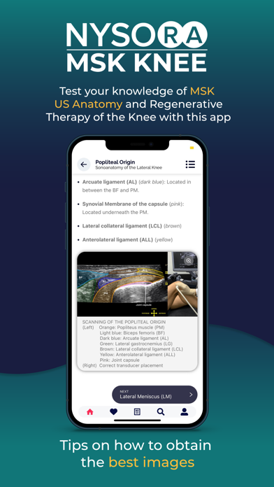 NYSORA MSK US Kneeのおすすめ画像3