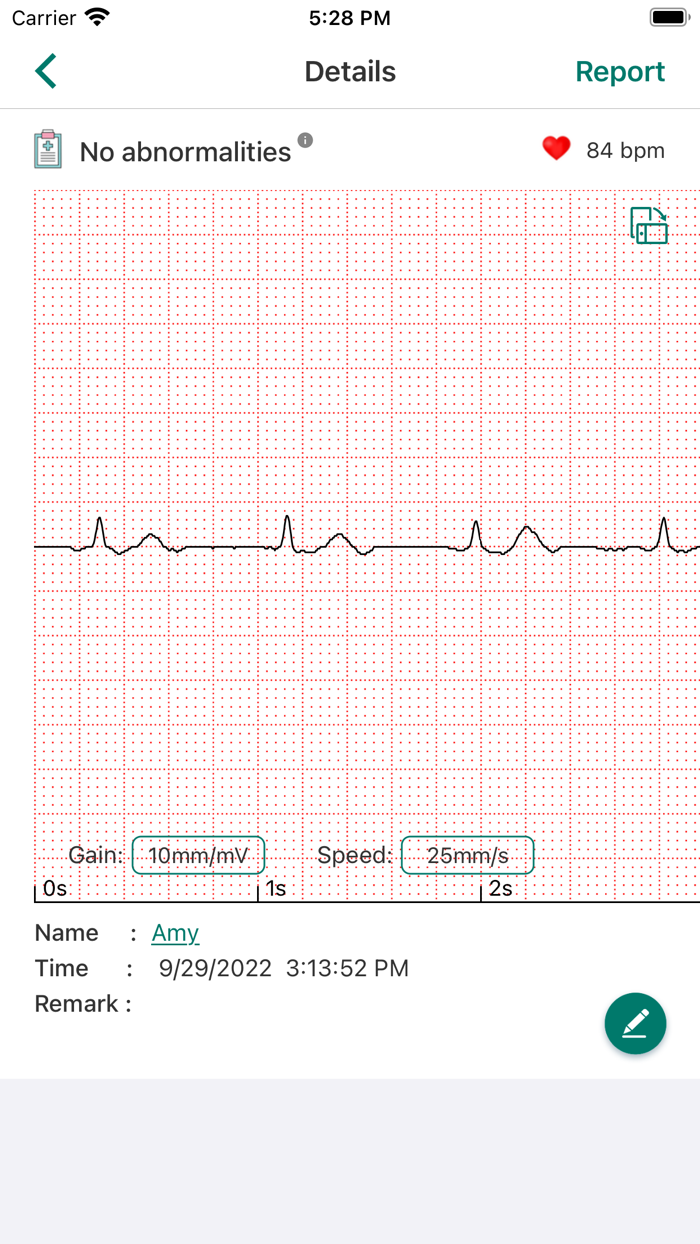 EMAY Portable ECG Monitor