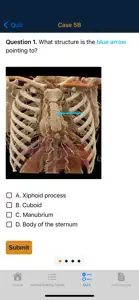 CTisus Chest Atlas 3D CRT screenshot #7 for iPhone