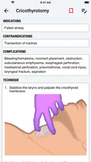 palmem: em quick reference aid problems & solutions and troubleshooting guide - 1