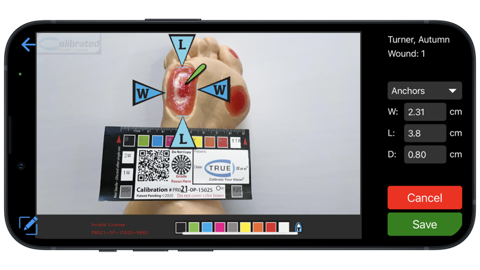 TRUE-See® Mobile App