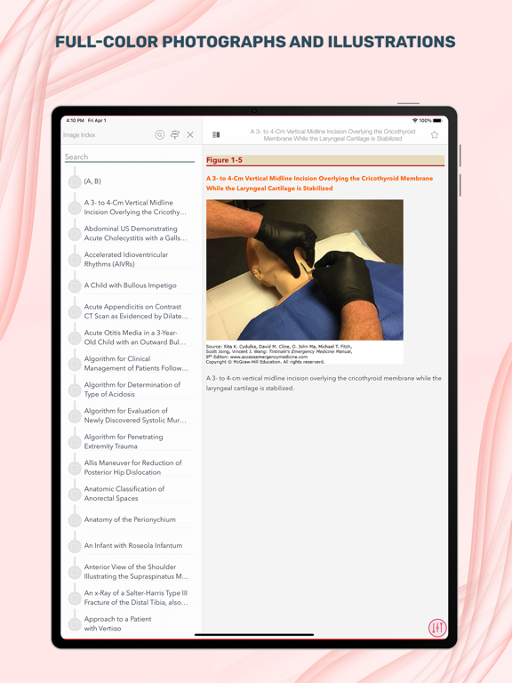 Screenshot #3 for Tintinalli's Emergency Med Man