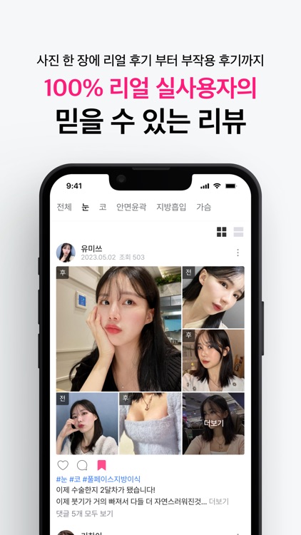 쀼 - 성형, 피부 숏폼 영상 후기 앱 screenshot-5