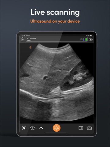 Clarius Ultrasound Appのおすすめ画像2