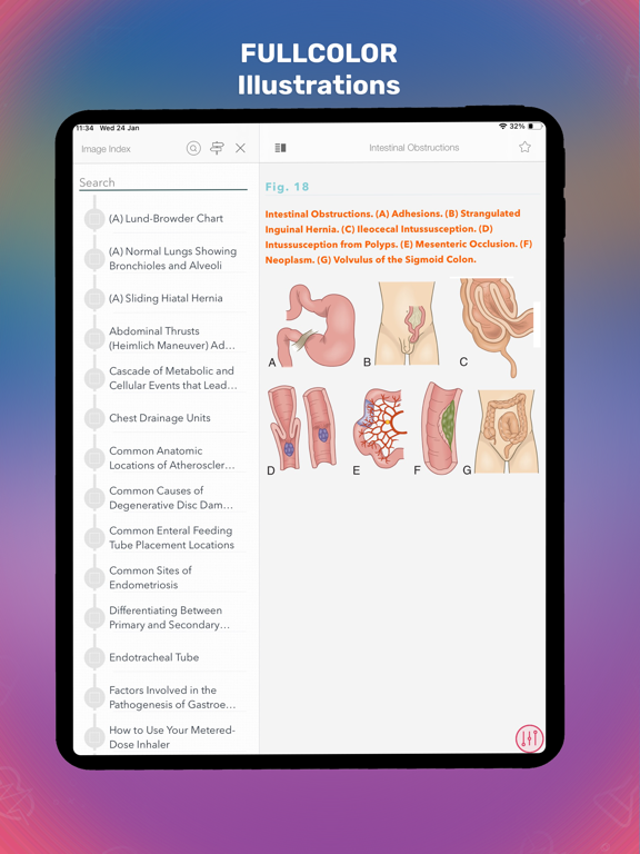 Screenshot #6 pour Medical Surgical Nursing Lewis