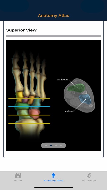 CTisus: CT of the Foot screenshot-4