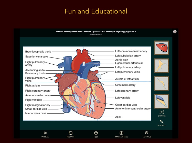 Anatomy Puzzles