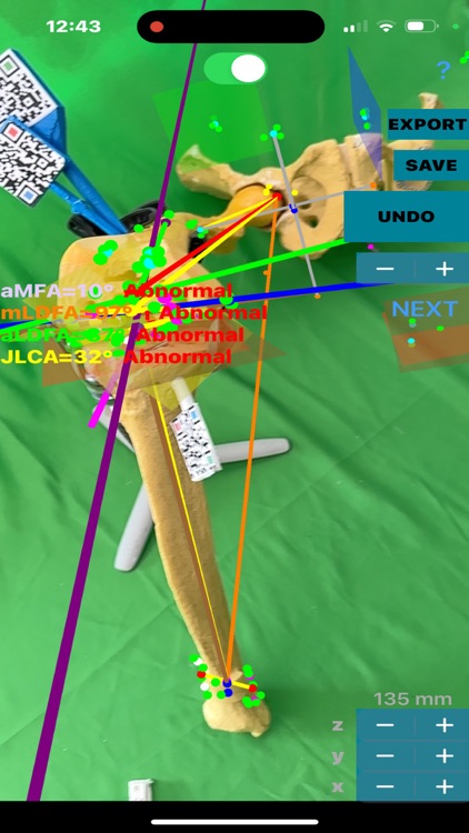 KneeNaviAR screenshot-7