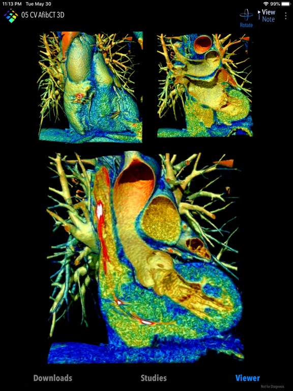 MedVizi™ CT-MRI Viewer iPad screenshot 8 - Medical app