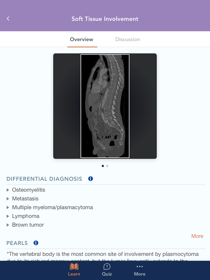 CTisus L-Spine Pathology