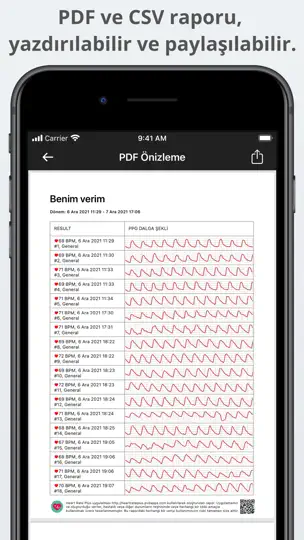 Heart Rate Plus iPhone Ekran Görüntüsü 3