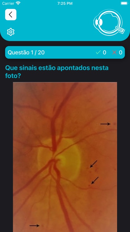 Retina Fácil IST screenshot-6