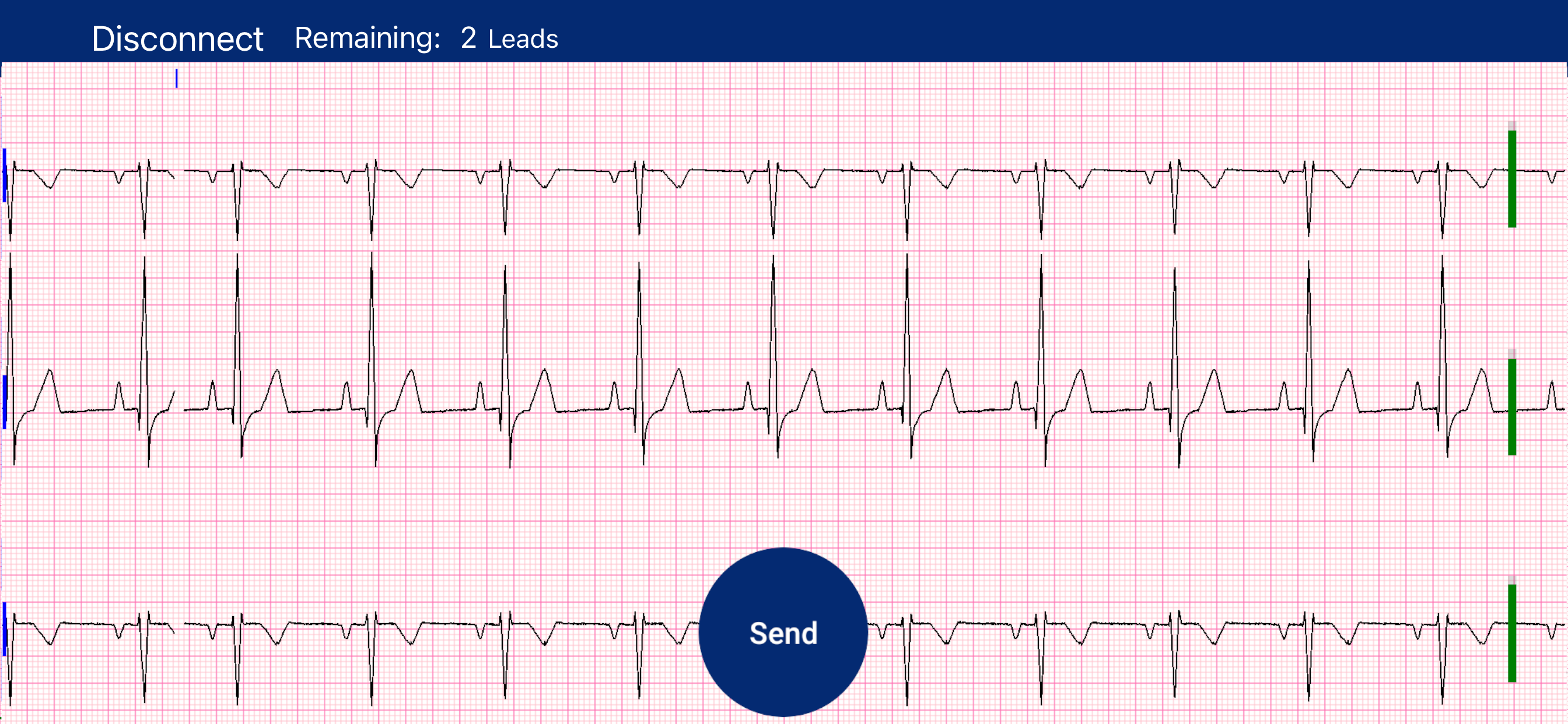 MyRhythm Connect