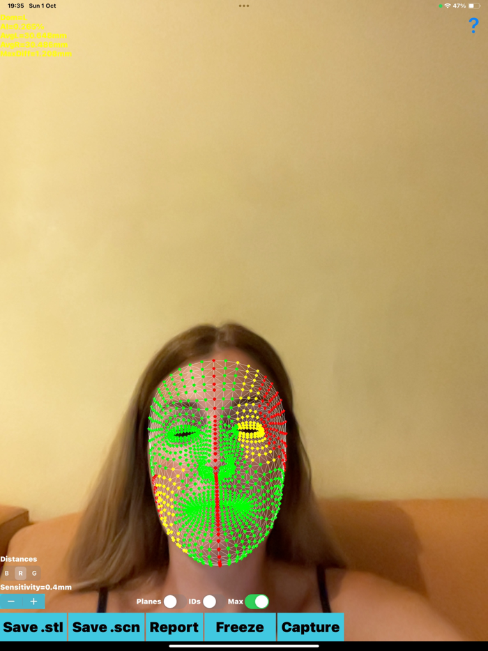 Dynamic3DFaceAsymmetryApp