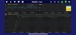 VEEGix EEG screenshot #2 for iPhone